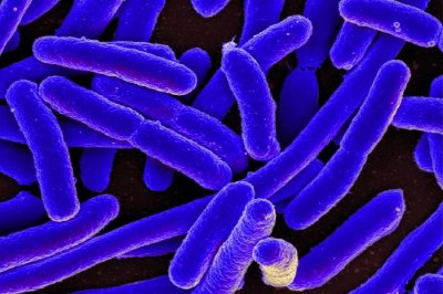 2 die as U.K. health officials investigate hundreds of E. coli cases nationwide