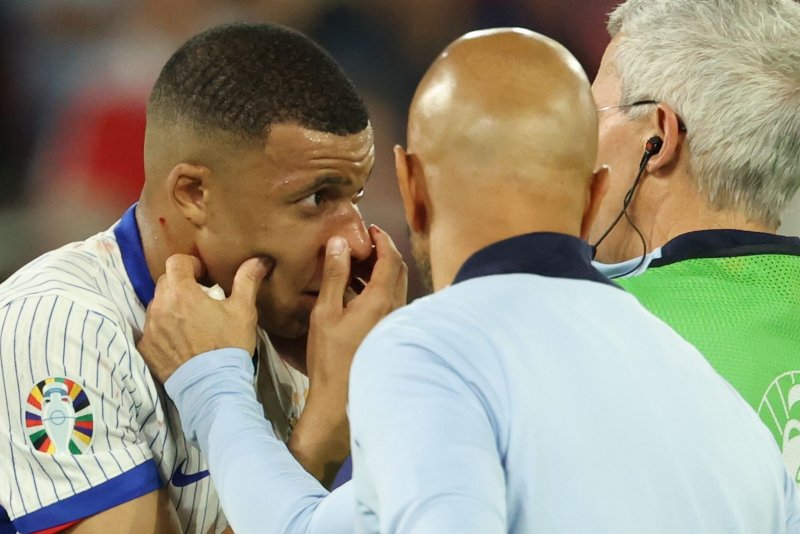 French striker Kylian Mbappe receives medical treatment during a UEFA Euro 2024 Group D soccer match against Austria on Monday in Dusseldorf, Germany. Photo by Friedemann Vogel/EPA-EFE