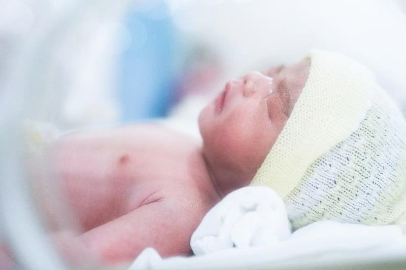 Low-birth-weight newborns have a higher risk of health complications if they become obese as children, a new study has found. Photo by Adobe Stock/HealthDay News